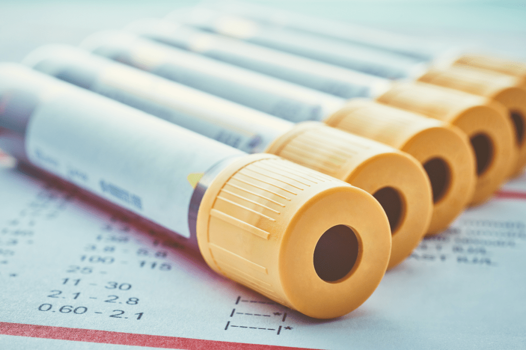 Biometría Hemática Automatizada vs. Manual: ¿Cuál es más&nbsp;precisa?