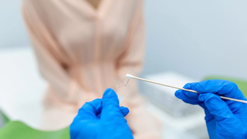 Decodificando los resultados: Cómo interpretar los hallazgos de un Papanicolau