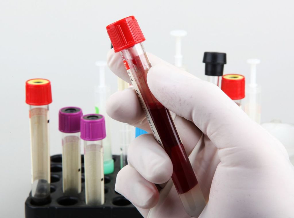 Mitos y Realidades del Perfil Tiroideo: Despejando Dudas