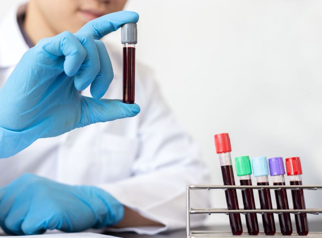 La Química Sanguínea y tu Corazón: Indicadores Clave para la Salud&nbsp;Cardiovascular