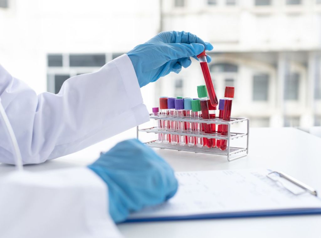 Pruebas de VIH en el Siglo XXI: Nuevas Tecnologías y Acceso a la&nbsp;Detección