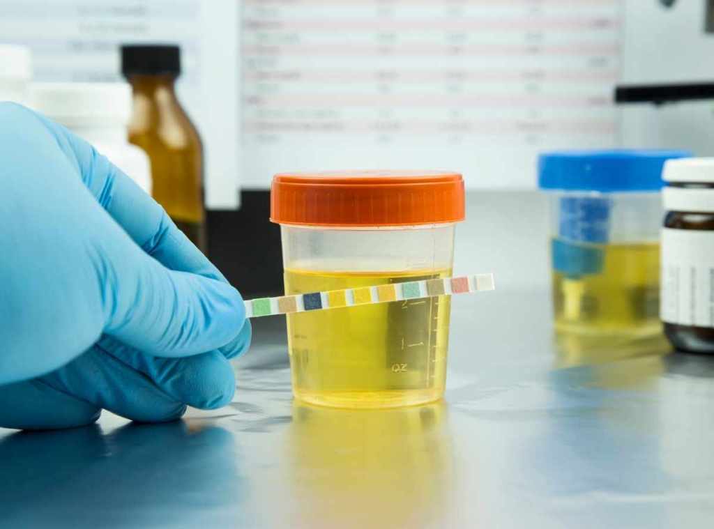 Embarazo y examen general de orina: consejos y&nbsp;precauciones