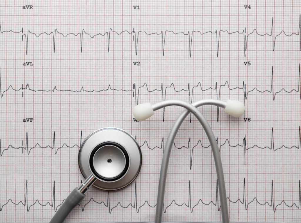¿Qué precauciones se deben tomar antes de un electrocardiograma si estoy&nbsp;embarazada?