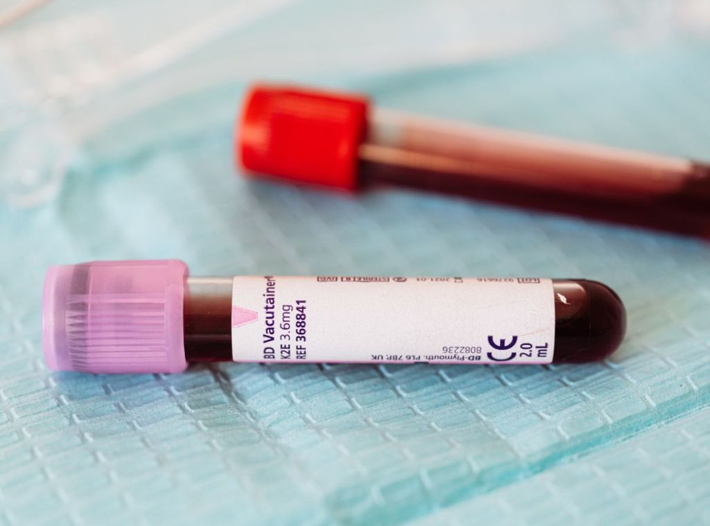 Los peligros de no tratar un perfil tiroideo alterado